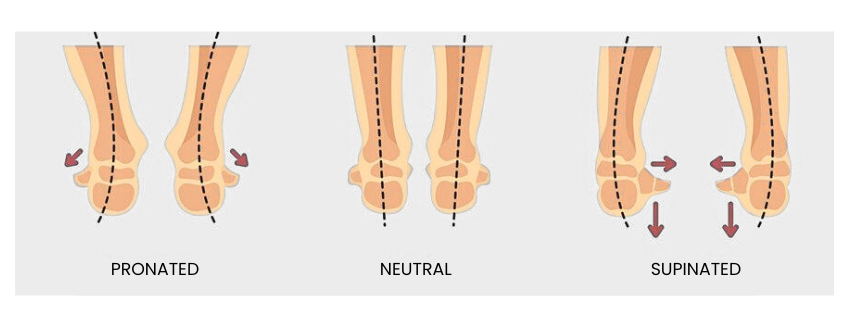 Types of Feet Based on pronated supinated Shape socks for FLAT FOOT padded cushion socks for foot pain men and women